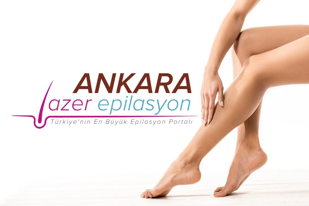 ankara lazer epilasyon