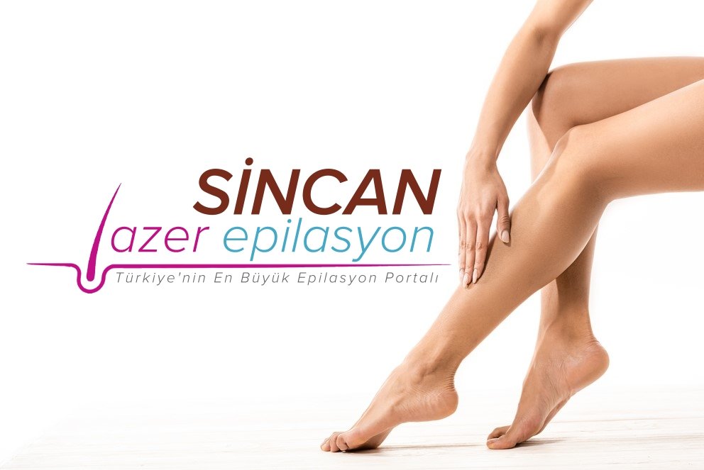 sincan lazer epilasyon