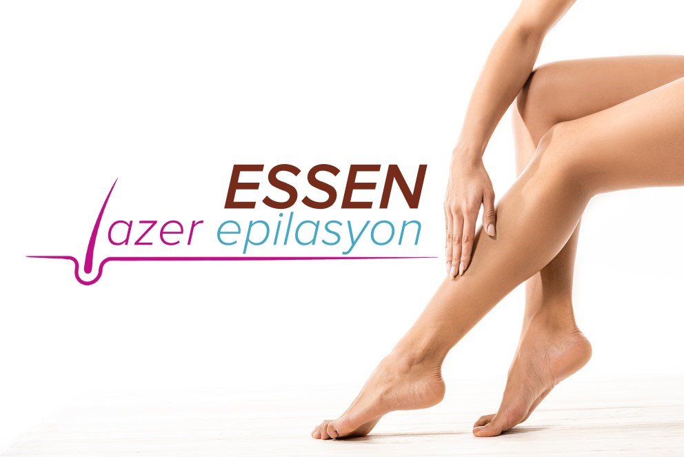 essen lazer epilasyon