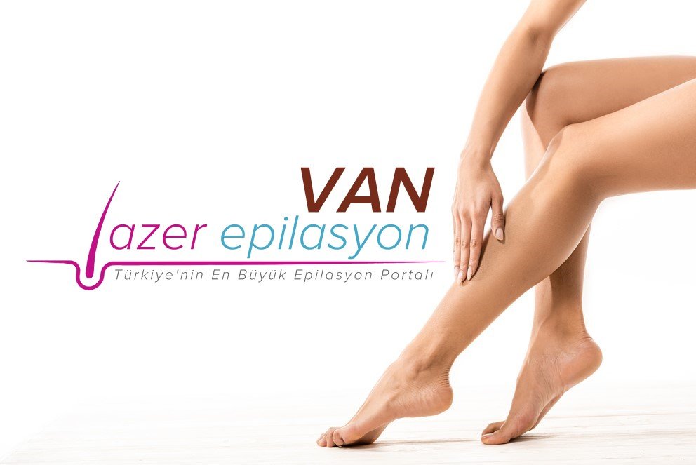 van lazer epilasyon